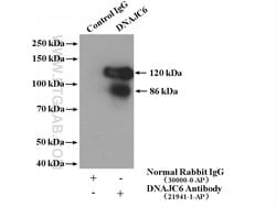 DNAJC6/AUXILIN Rabbit anti-Human, Mouse, Rat, Polyclonal, Proteintech 150