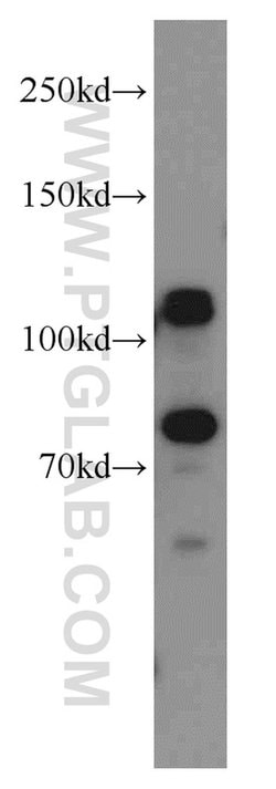DNAJC6/AUXILIN Rabbit anti-Human, Mouse, Rat, Polyclonal, Proteintech 150