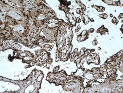 SH3BGRL2 Rabbit anti-Human, Mouse, Polyclonal, Proteintech:Antibodies:Primary