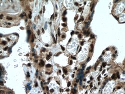SH3BGRL2 Rabbit anti-Human, Mouse, Polyclonal, Proteintech:Antibodies:Primary