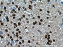 SH3BGRL2 Rabbit anti-Human, Mouse, Polyclonal, Proteintech:Antibodies:Primary