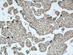 SH3BGRL2 Rabbit anti-Human, Mouse, Polyclonal, Proteintech:Antibodies:Primary
