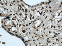 SH3BGRL2 Rabbit anti-Human, Mouse, Polyclonal, Proteintech:Antibodies:Primary