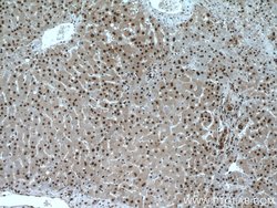 SH3BGRL2 Rabbit anti-Human, Mouse, Polyclonal, Proteintech:Antibodies:Primary