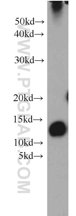 SH3BGRL2 Rabbit anti-Human, Mouse, Polyclonal, Proteintech:Antibodies:Primary