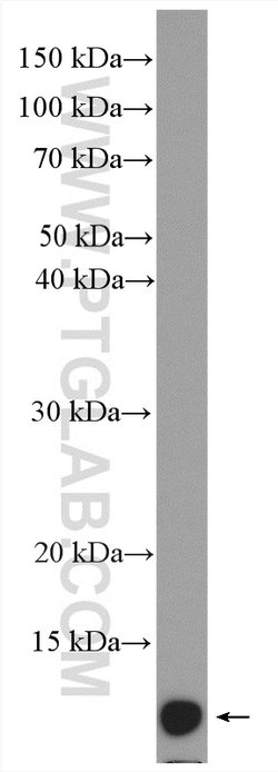 SH3BGRL2 Rabbit anti-Human, Mouse, Polyclonal, Proteintech:Antibodies:Primary