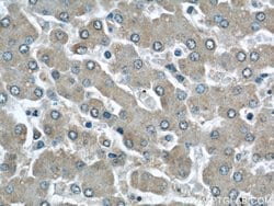 LOC286135 Rabbit anti-Human, Mouse, Polyclonal, Proteintech:Antibodies:Primary