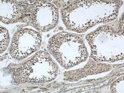 LOC286135 Rabbit anti-Human, Mouse, Polyclonal, Proteintech:Antibodies:Primary