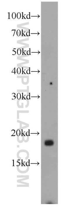 LOC286135 Rabbit anti-Human, Mouse, Polyclonal, Proteintech:Antibodies:Primary