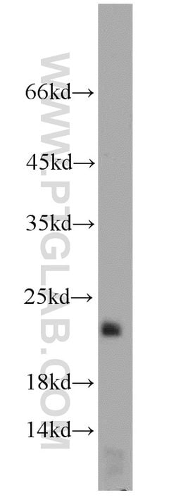 LOC286135 Rabbit anti-Human, Mouse, Polyclonal, Proteintech:Antibodies:Primary