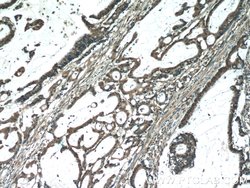 MACC1 Rabbit anti-Human, Mouse, Polyclonal, Proteintech:Antibodies:Primary