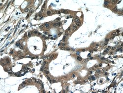 MACC1 Rabbit anti-Human, Mouse, Polyclonal, Proteintech:Antibodies:Primary