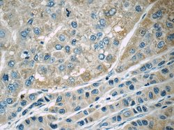 MACC1 Rabbit anti-Human, Mouse, Polyclonal, Proteintech:Antibodies:Primary