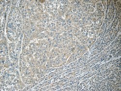 MACC1 Rabbit anti-Human, Mouse, Polyclonal, Proteintech:Antibodies:Primary