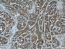 MACC1 Rabbit anti-Human, Mouse, Polyclonal, Proteintech:Antibodies:Primary
