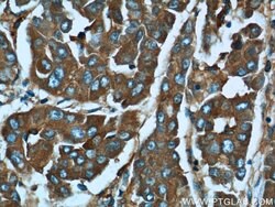 MACC1 Rabbit anti-Human, Mouse, Polyclonal, Proteintech:Antibodies:Primary