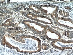 ALCAM Rabbit anti-Human, Polyclonal, Proteintech:Antibodies:Primary Antibodies