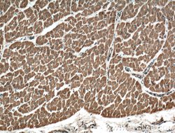 TSPAN31 Rabbit anti-Human, Mouse, Polyclonal, Proteintech:Antibodies:Primary