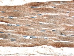 TSPAN31 Rabbit anti-Human, Mouse, Polyclonal, Proteintech:Antibodies:Primary