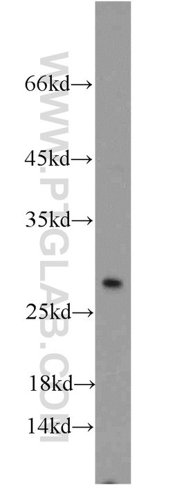 TSPAN31 Rabbit anti-Human, Mouse, Polyclonal, Proteintech:Antibodies:Primary