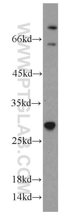 TSPAN31 Rabbit anti-Human, Mouse, Polyclonal, Proteintech:Antibodies:Primary