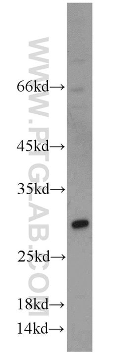 TSPAN31 Rabbit anti-Human, Mouse, Polyclonal, Proteintech:Antibodies:Primary