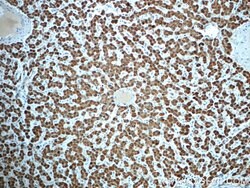 PCCA Rabbit anti-Human, Mouse, Polyclonal, Proteintech:Antibodies:Primary