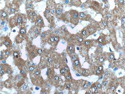 PCCA Rabbit anti-Human, Mouse, Polyclonal, Proteintech:Antibodies:Primary