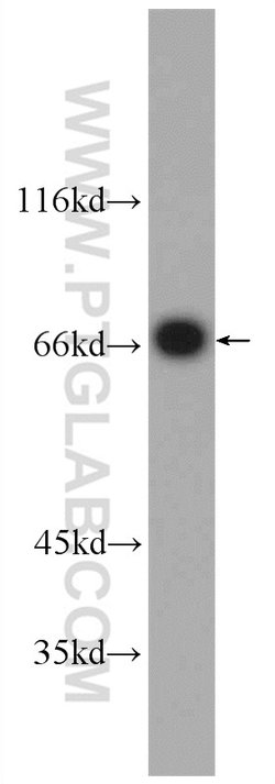 PCCA Rabbit anti-Human, Mouse, Polyclonal, Proteintech:Antibodies:Primary