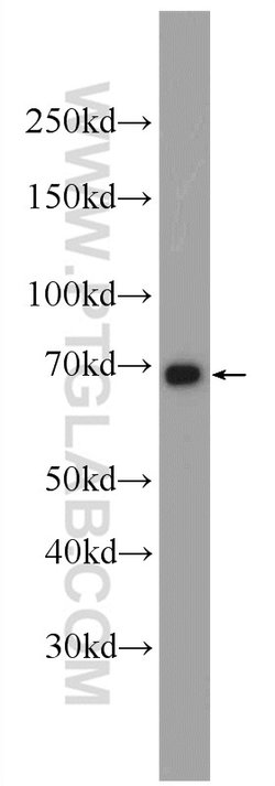 PCCA Rabbit anti-Human, Mouse, Polyclonal, Proteintech:Antibodies:Primary