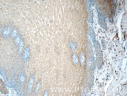 Annexin A1 Rabbit anti-Human, Mouse, Rat, Polyclonal, Proteintech 150 μL;