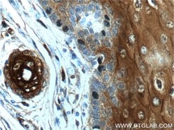 Annexin A1 Rabbit anti-Human, Mouse, Rat, Polyclonal, Proteintech 150 μL;