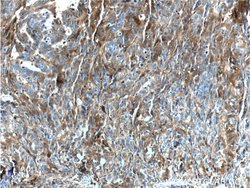 Annexin A1 Rabbit anti-Human, Mouse, Rat, Polyclonal, Proteintech 150 μL;
