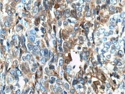 Annexin A1 Rabbit anti-Human, Mouse, Rat, Polyclonal, Proteintech 150 μL;