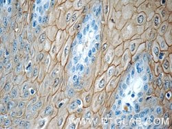 Annexin A1 Rabbit anti-Human, Mouse, Rat, Polyclonal, Proteintech 150 μL;
