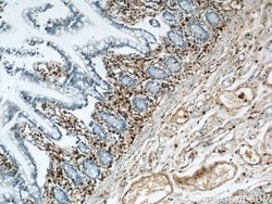 Annexin A1 Rabbit anti-Human, Mouse, Rat, Polyclonal, Proteintech 150 μL;