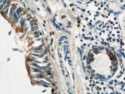 Annexin A1 Rabbit anti-Human, Mouse, Rat, Polyclonal, Proteintech 150 μL;