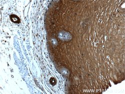 Annexin A1 Rabbit anti-Human, Mouse, Rat, Polyclonal, Proteintech 150 μL;
