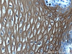 Annexin A1 Rabbit anti-Human, Mouse, Rat, Polyclonal, Proteintech 150 μL;