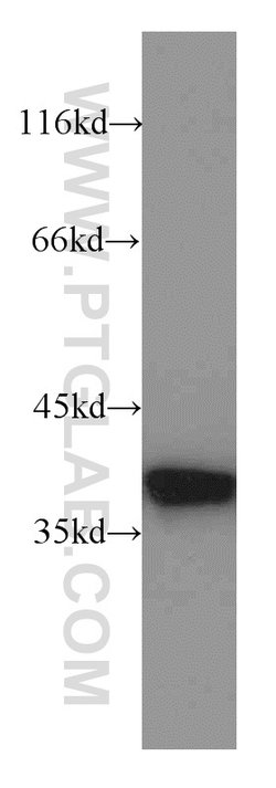 Annexin A1 Rabbit anti-Human, Mouse, Rat, Polyclonal, Proteintech 150 μL;
