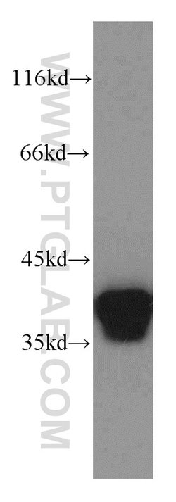 Annexin A1 Rabbit anti-Human, Mouse, Rat, Polyclonal, Proteintech 150 μL;