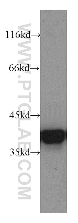 Annexin A1 Rabbit anti-Human, Mouse, Rat, Polyclonal, Proteintech 150 μL;
