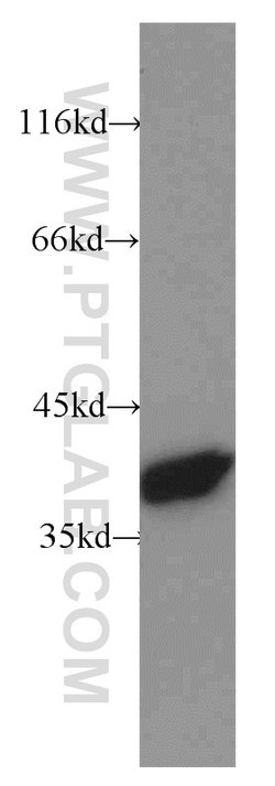 Annexin A1 Rabbit anti-Human, Mouse, Rat, Polyclonal, Proteintech 150 μL;