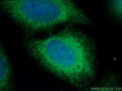 LAMP1 Rabbit anti-Human, Polyclonal, Proteintech 150 &mu;L; Unconjugated:Antibodies,