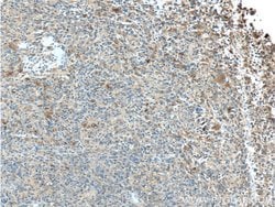 LAMP1 Rabbit anti-Human, Polyclonal, Proteintech 150 &mu;L; Unconjugated:Antibodies,
