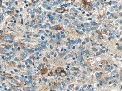 LAMP1 Rabbit anti-Human, Polyclonal, Proteintech 150 &mu;L; Unconjugated:Antibodies,