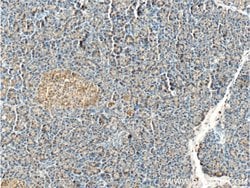 LAMP1 Rabbit anti-Human, Polyclonal, Proteintech 150 &mu;L; Unconjugated:Antibodies,