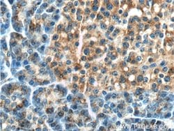 LAMP1 Rabbit anti-Human, Polyclonal, Proteintech 150 &mu;L; Unconjugated:Antibodies,