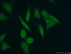 PHF20 Rabbit anti-Human, Mouse, Polyclonal, Proteintech:Antibodies:Primary