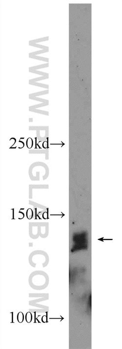 PHF20 Rabbit anti-Human, Mouse, Polyclonal, Proteintech:Antibodies:Primary